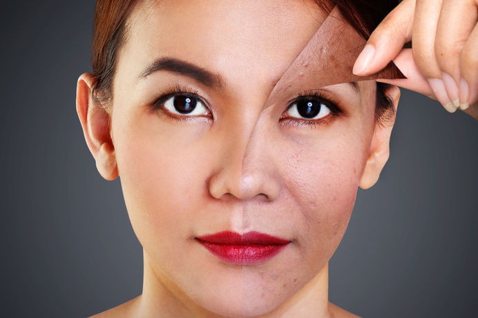 Memasuki Usia 30 Tahun Ini Perubahan Kulit Yang Akan Terjadi Womantalk