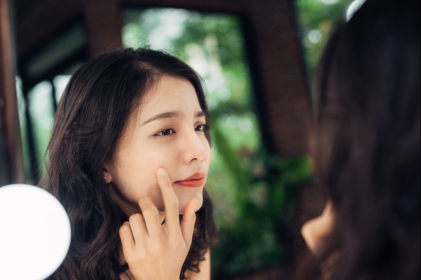 8 Dark Spot Corrector Untuk Hilangkan Bekas Jerawat Womantalk